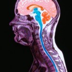 Understanding a headache