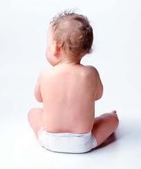 Remedies for diaper rash sometimes involve little more than common sense!
