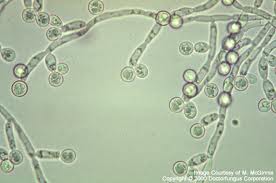 What is Candida albicans? A fungus that is natural in your body but can grow out of control!